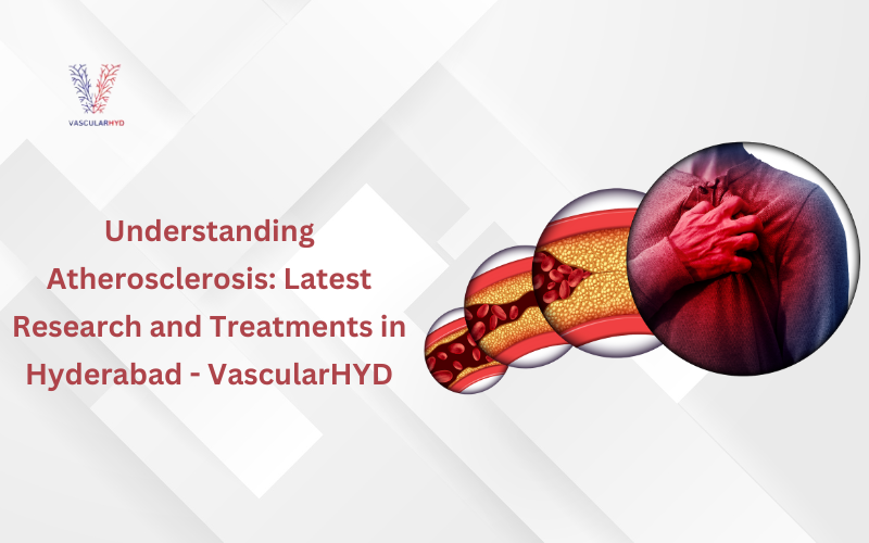Understanding Atherosclerosis: Latest Research and Treatments in Hyderabad - VascularHYD