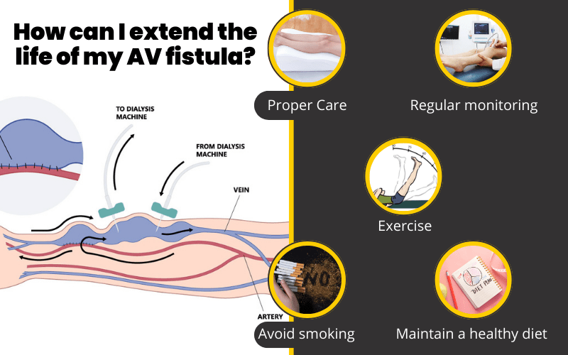 How can I extend the life of my AV fistula?